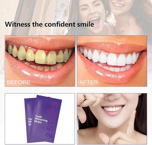 7pcs Premium Purple Whitening Strips Professional Tooth Stain Removal