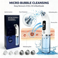 Micro-Bubble Beauty Device – Blackhead Remover & Deep Pore Cleanser